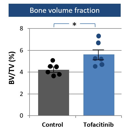 Publication thumbnail: JAK 阻害は安定状態で骨量を増加し、破骨細胞刺激による病的骨量減少を改善