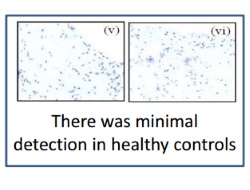 Publication thumbnail: Hipoksi ve STAT3 sinyalizasyonunun etkileşimleri romatoid artritte proinflamatuvar yolları düzenler
